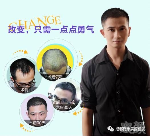 https://img.miyanlife.com/mnt/timg/170724/1P350B62-5.jpg