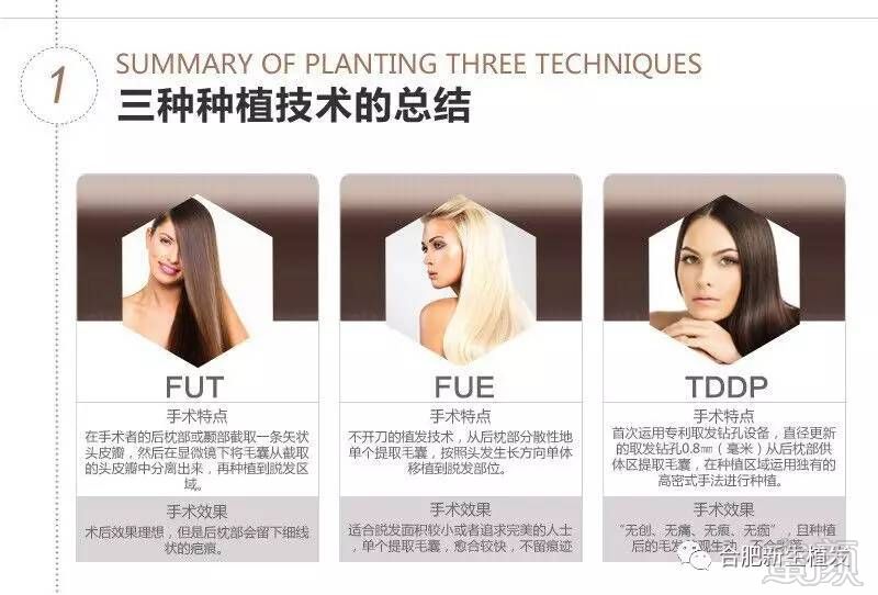 https://img.miyanlife.com/mnt/timg/170724/1Q34K5c-1.jpg
