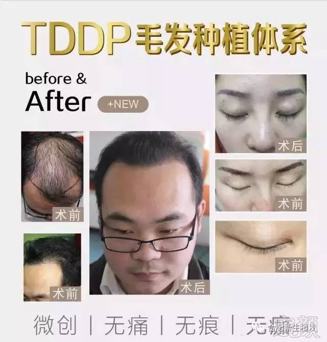 https://img.miyanlife.com/mnt/timg/170724/1Q34U424-2.jpg
