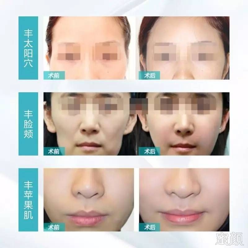 https://img.miyanlife.com/mnt/timg/170724/1S92BE4-6.jpg
