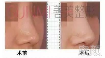 https://img.miyanlife.com/mnt/timg/170725/1611461113-4.jpg