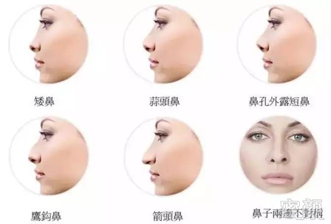 https://img.miyanlife.com/mnt/timg/170725/16114B531-5.jpg