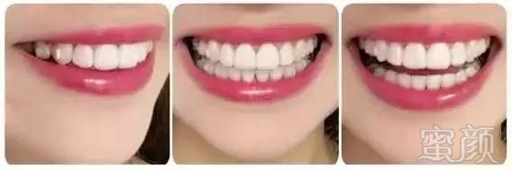 https://img.miyanlife.com/mnt/timg/170726/1324531632-9.jpg