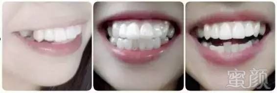 https://img.miyanlife.com/mnt/timg/170726/132453C48-8.jpg