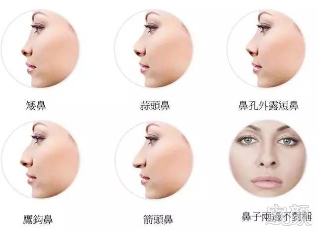 https://img.miyanlife.com/mnt/timg/170726/135QS329-6.jpg