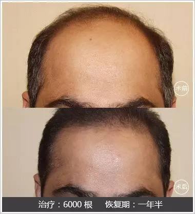 https://img.miyanlife.com/mnt/timg/170726/1424591259-3.jpg