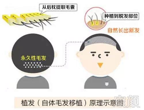 https://img.miyanlife.com/mnt/timg/170726/1424592504-1.jpg