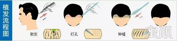 https://img.miyanlife.com/mnt/timg/170726/14245aZ1-4.jpg