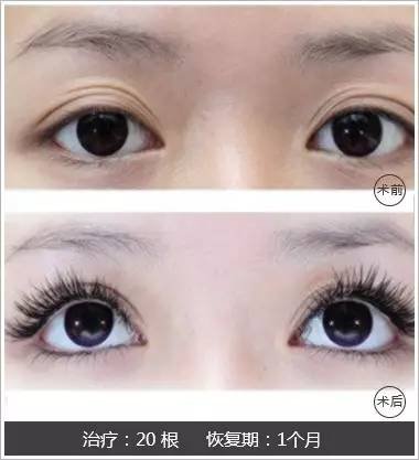 https://img.miyanlife.com/mnt/timg/170726/1425003596-5.jpg