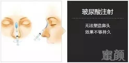 https://img.miyanlife.com/mnt/timg/170726/1444093105-14.jpg