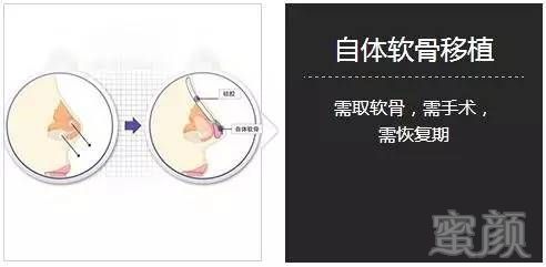 https://img.miyanlife.com/mnt/timg/170726/1444106217-18.jpg