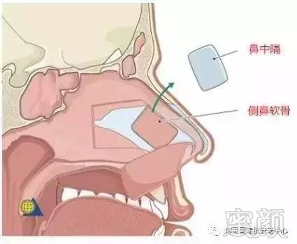 https://img.miyanlife.com/mnt/timg/170726/16220V630-5.jpg
