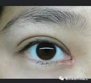 眼輪匝肌(orbicularis oculi muscle)圍繞眼睛,負責保護眼球及閉眼