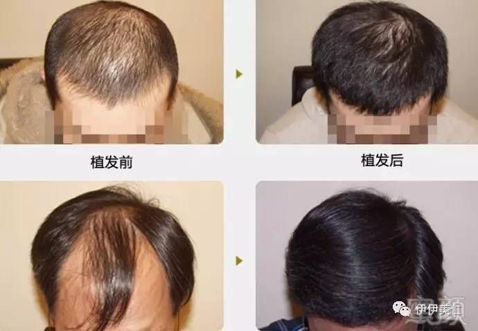 https://img.miyanlife.com/mnt/timg/170728/161G5K52-6.jpg