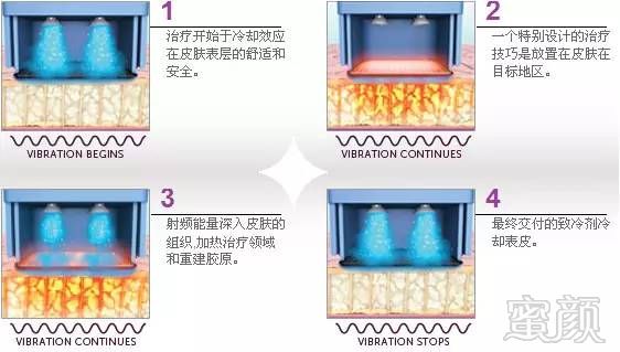 案例图片