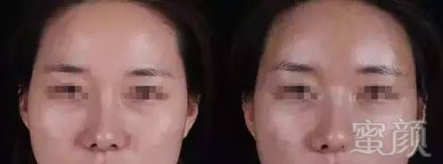 https://img.miyanlife.com/mnt/timg/170730/2135452611-1.jpg