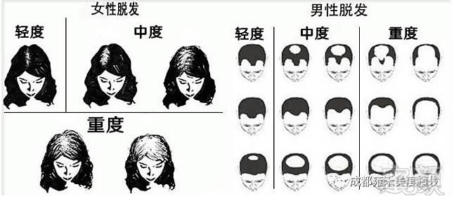https://img.miyanlife.com/mnt/timg/170730/213A135a-2.jpg