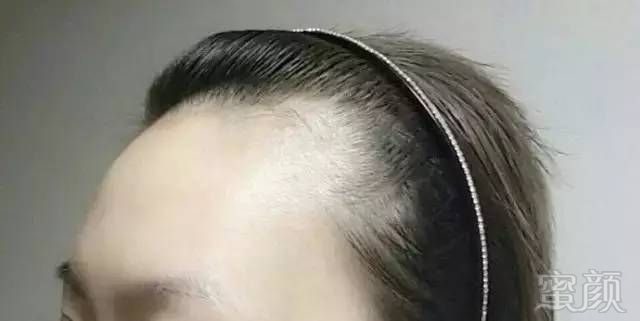 https://img.miyanlife.com/mnt/timg/170730/213H632H-1.jpg