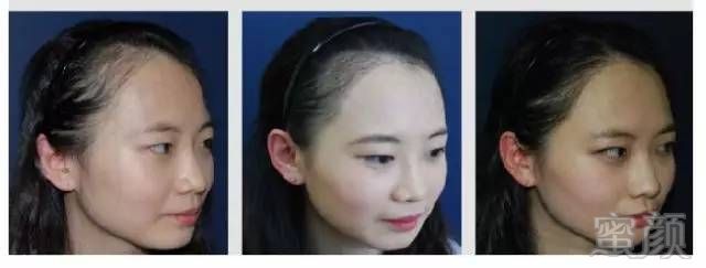 https://img.miyanlife.com/mnt/timg/170730/213H63c5-4.jpg