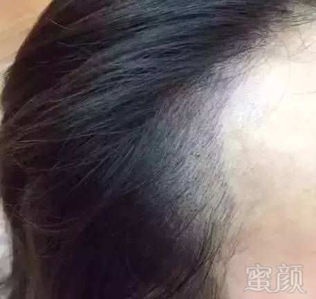 https://img.miyanlife.com/mnt/timg/170730/213HB949-2.jpg