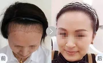https://img.miyanlife.com/mnt/timg/170730/213HC153-3.jpg