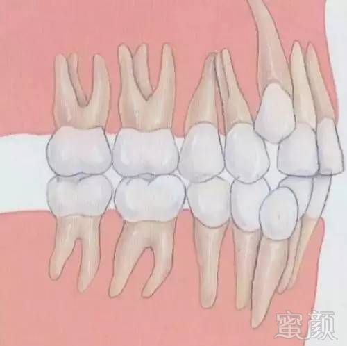 https://img.miyanlife.com/mnt/timg/170731/153Z3M20-3.jpg