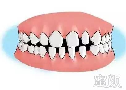 https://img.miyanlife.com/mnt/timg/170731/153Z41325-4.jpg