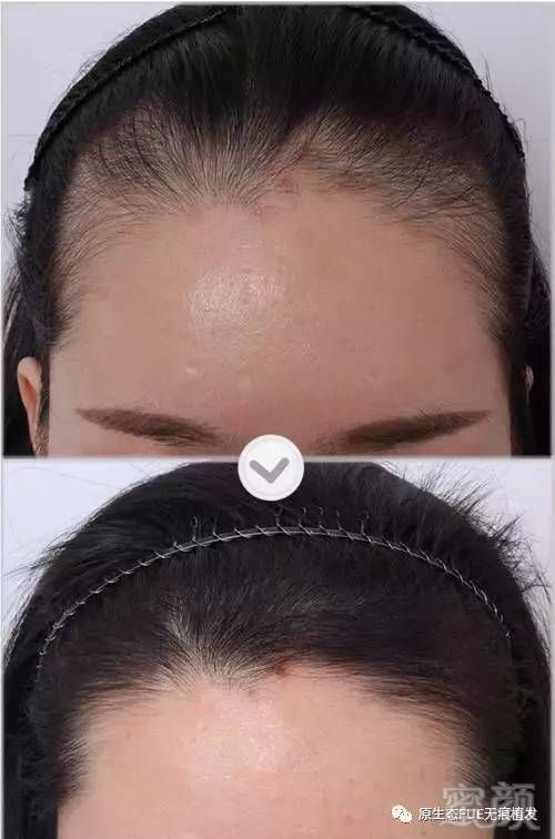 https://img.miyanlife.com/mnt/timg/170731/1FI13646-6.jpg