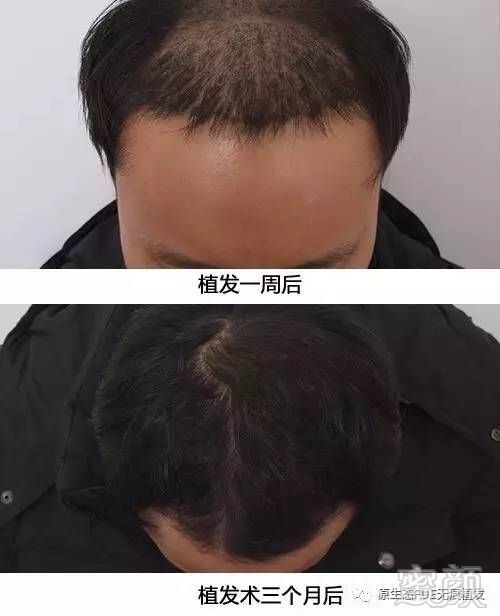 https://img.miyanlife.com/mnt/timg/170731/1FI15D4-7.jpg