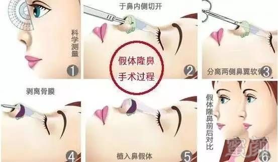 https://img.miyanlife.com/mnt/timg/170731/1I541M14-3.jpg