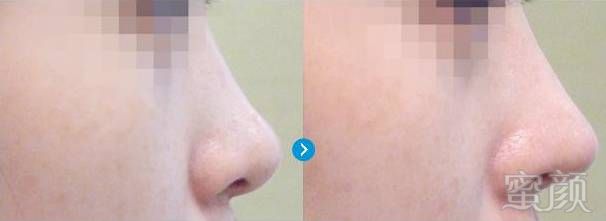 https://img.miyanlife.com/mnt/timg/170731/1I5431Y8-10.jpg