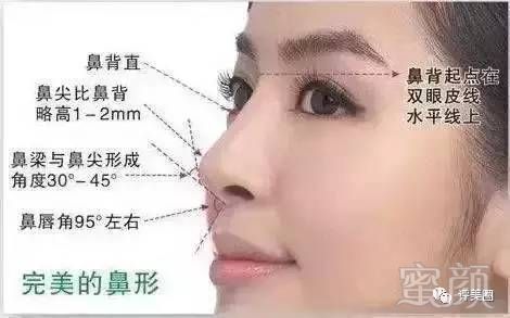 https://img.miyanlife.com/mnt/timg/170731/20021434Y-0.jpg