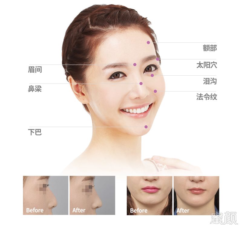https://img.miyanlife.com/mnt/timg/170802/1500214954-7.jpg
