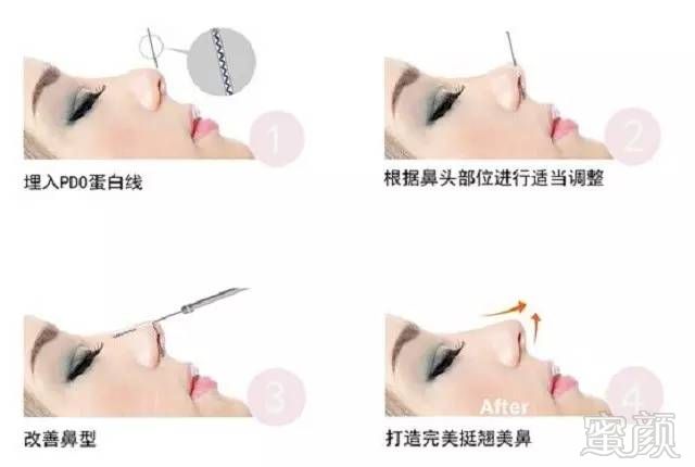 https://img.miyanlife.com/mnt/timg/170802/1613491314-4.jpg