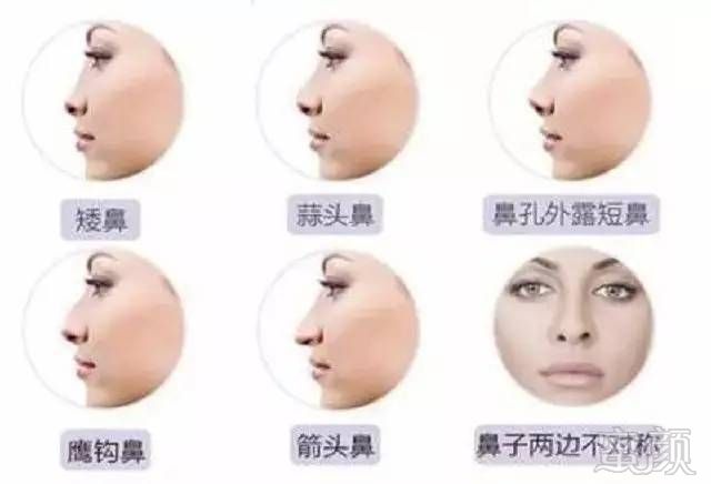 https://img.miyanlife.com/mnt/timg/170802/1613493361-6.jpg