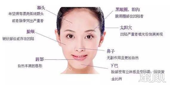 https://img.miyanlife.com/mnt/timg/170802/1910033050-0.jpg
