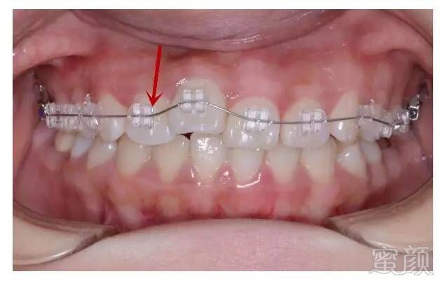 https://img.miyanlife.com/mnt/timg/170802/1933293462-12.jpg