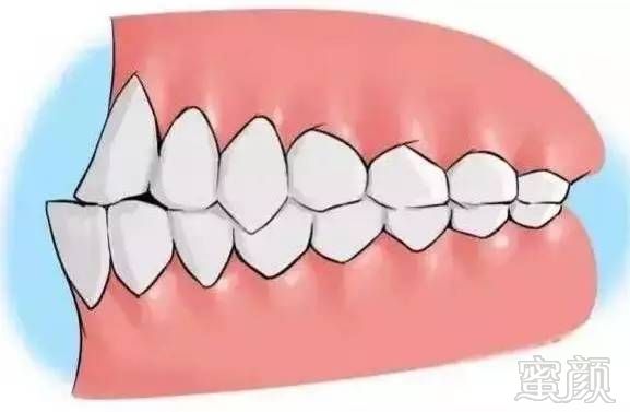 https://img.miyanlife.com/mnt/timg/170802/19332RW7-7.jpg