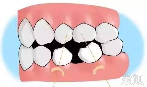 https://img.miyanlife.com/mnt/timg/170802/19332S524-8.jpg
