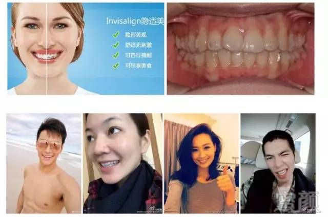 https://img.miyanlife.com/mnt/timg/170802/1933304207-14.jpg