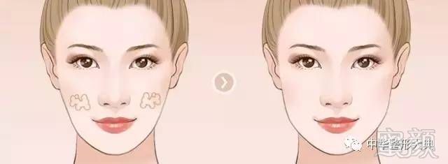 https://img.miyanlife.com/mnt/timg/170802/1FG13955-0.jpg