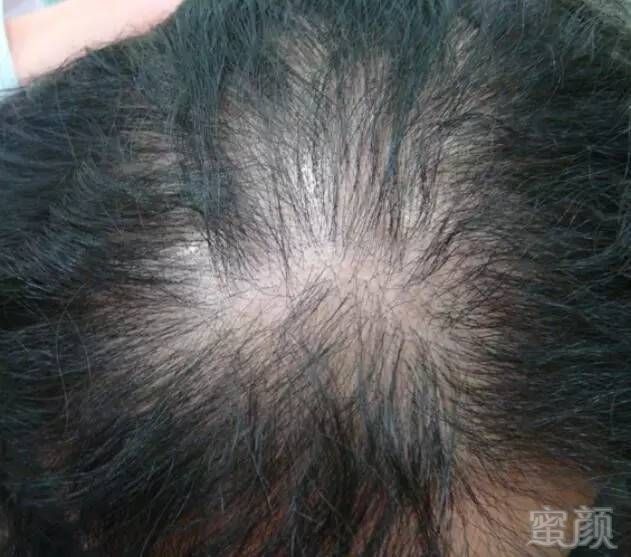 https://img.miyanlife.com/mnt/timg/170802/1HK64222-8.jpg