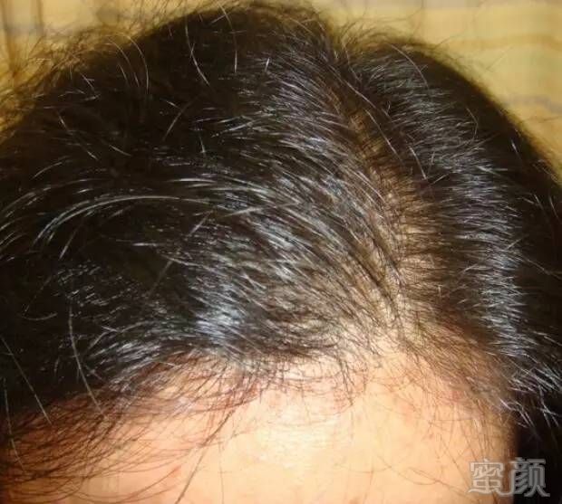 https://img.miyanlife.com/mnt/timg/170802/1HKG054-9.jpg