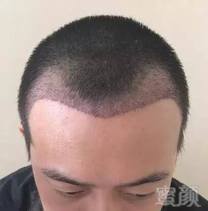 https://img.miyanlife.com/mnt/timg/170802/1HKTG1-11.jpg