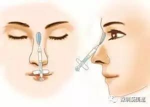 https://img.miyanlife.com/mnt/timg/170802/1I9455U2-4.jpg