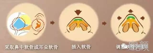 https://img.miyanlife.com/mnt/timg/170802/1I945MM-5.jpg