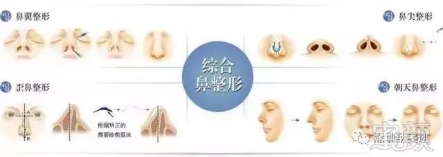 https://img.miyanlife.com/mnt/timg/170802/1I94M357-11.jpg