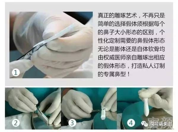 https://img.miyanlife.com/mnt/timg/170802/1I94U0Y-12.jpg