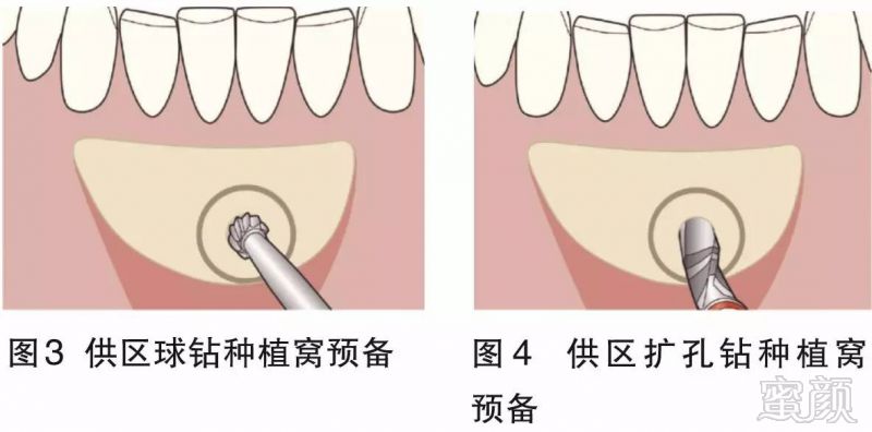 案例图片