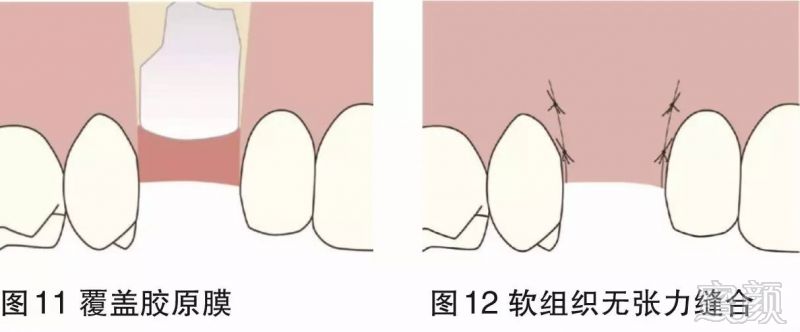 案例图片